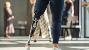 Potrzebujesz dofinansowania do protezy lub rehabilitacji? Fundacja Poland Business Run szuka beneficjentów!